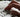 How can I treat Repetitive Strain Injury (RSI)? - Back2 International